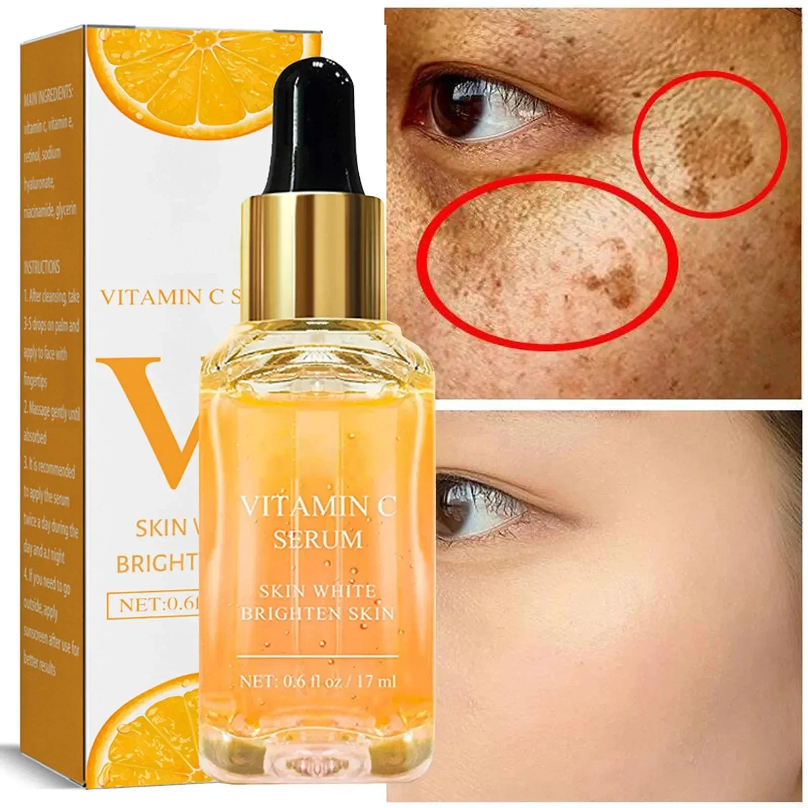 Vitamin C Remove Dark Spots face Serum Whiten Fade Freckles Anti-wrinkle Brighten Moisturize Collagen Korean Face Care Makeup