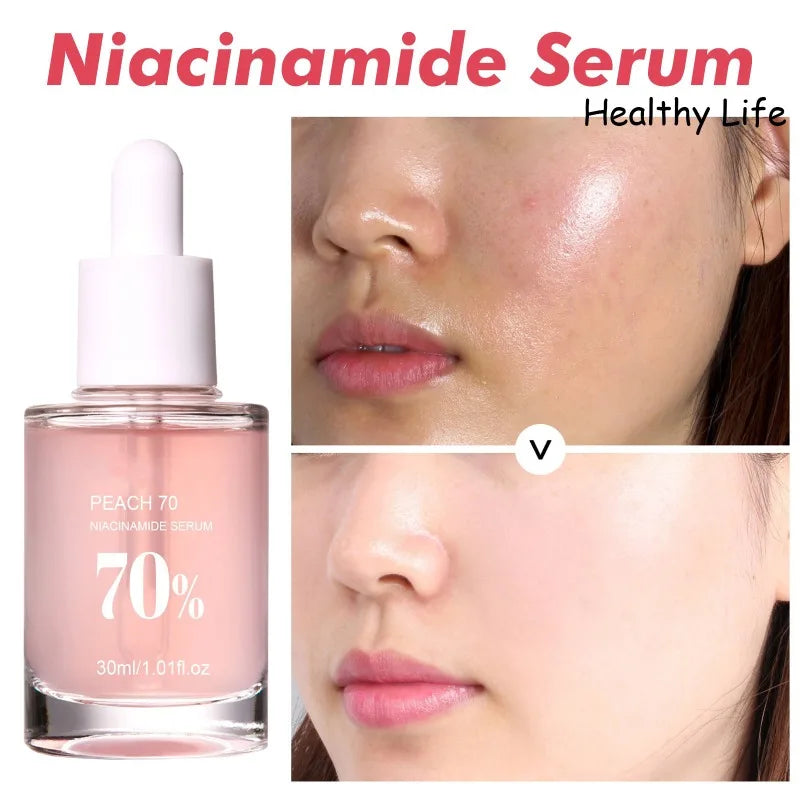 Peach Niacinamide Essence Fade Fine Lines Facial Serum Women Moisturize Brighten Face Serum Fade Dull Melasma Lighten Skin Care