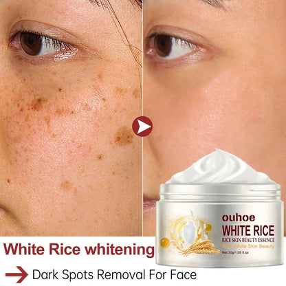 White Rice Face Whitening Cream Remove Dark Spots Fade Freckle Melanin Anti Wrinkle Aging Moisturizing Brighten Skin Care New